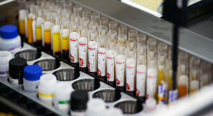 Comenzaron ensayos de la vacuna contra el VIH en humanos