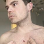 actor venezolano revelo que padece cancer de piel laverdaddemonagas.com fc dnlhxmayggig