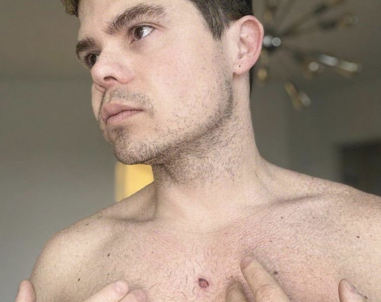 Actor venezolano reveló que padece cáncer de piel