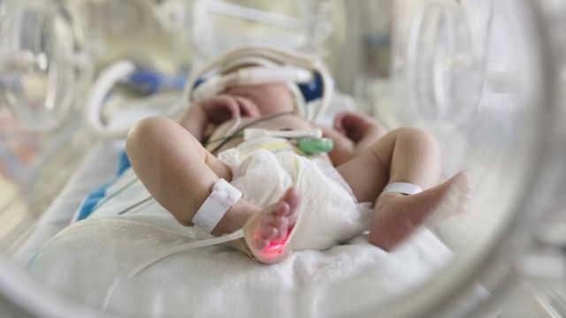 un bebe de tres semanas murio por covid 19 laverdaddemonagas.com 116543673 neonatal 1