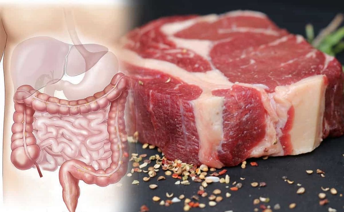 Relación existente entre la carne roja y el cáncer de colon