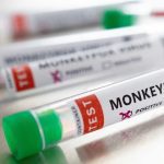 irlanda identifica primer caso de viruela del mono laverdaddemonagas.com nuevo proyecto 2022 05 26t074115.820