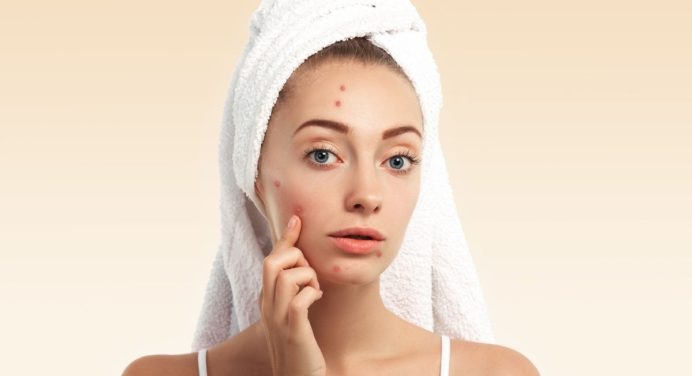 ¿Puntos negros en tu rostro? Elimínalos con productos que tienes en casa