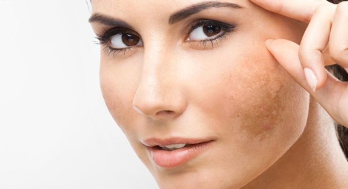 Realiza la mascarilla de avena para aclarar tu rostro