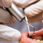 al menos 74 falsos ortodoncistas han sido capturados por el cicpc en 2022 laverdaddemonagas.com falsos ortodoncistas