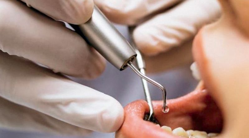 74 falsos ortodoncistas han sido capturados por el Cicpc en 2022