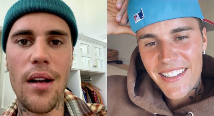 Justin Bieber reveló que sufre parálisis facial que le impide cantar