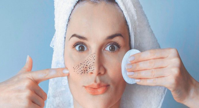 ¿Puntos Negros? Prueba estas 3 mascarillas y deshazte de ellos