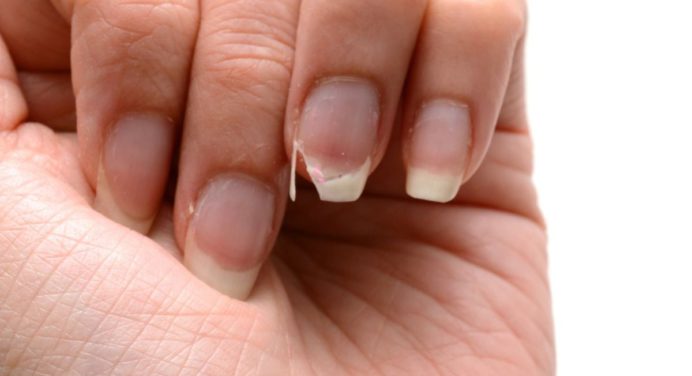 ¿Quieres uñas largas y fuertes? prueba con estos 4 remedios caseros