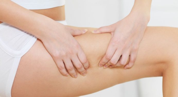 ¿Tienes celulitis? Estas 2 recetas son perfectas para combatirlas