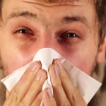 que son las alergias y cuales son las mas frecuentes laverdaddemonagas.com alergias 1