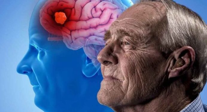 Descubre un sencillo ejercicio que reduce el riesgo de Alzheimer