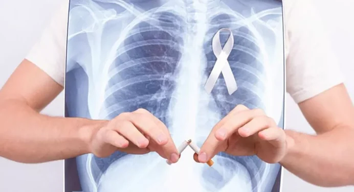 6 señales que pueden indicar cáncer de pulmón