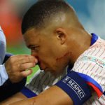 Kylian Mbappé está en recuperación