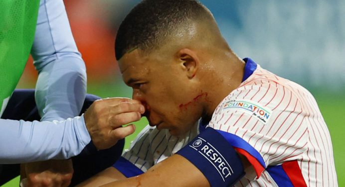 Kylian Mbappé está en recuperación y no se perderá el resto de Eurocopa 2024
