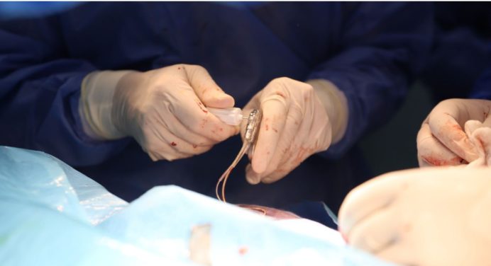 En nueva jornada del Centro Cardiovascular de Oriente implantan ocho marcapasos