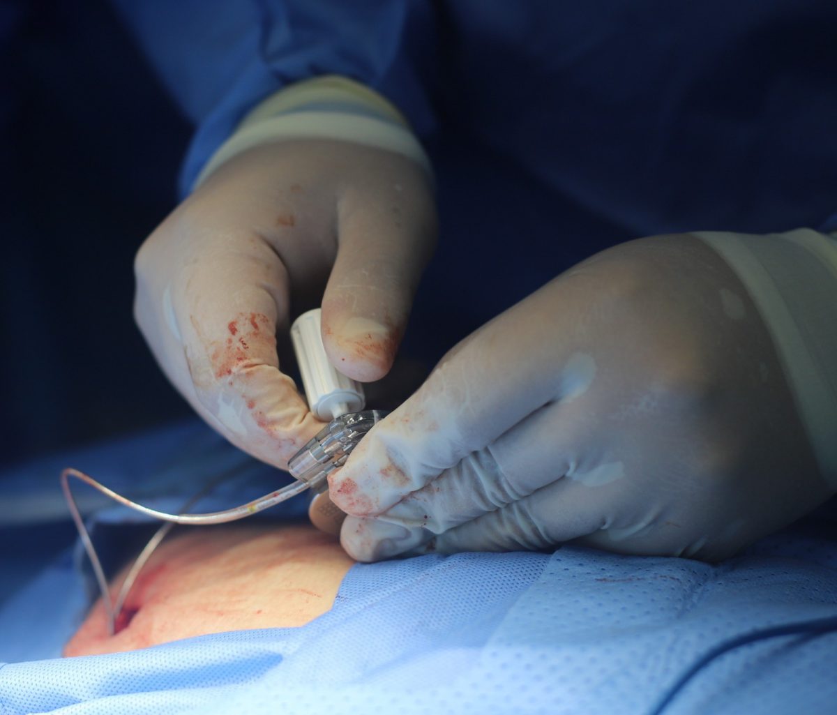 Cardiovascular de Oriente contabilizó 57 mil 53 atenciones en el 2025 2 cardio2