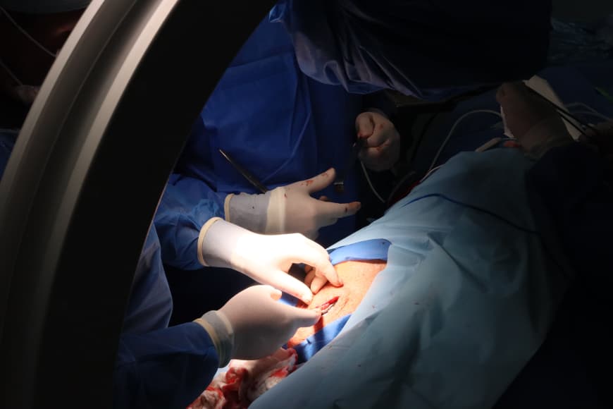 Cardiovascular de Oriente contabilizó 57 mil 53 atenciones en el 2025 5 cardio5