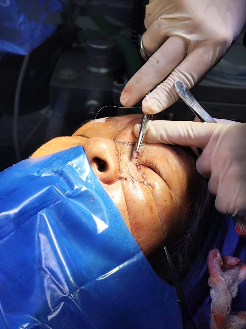 Realizan con éxito cirugía oncológica en renovados quirófanos del hospital Simón Bolívar 1 cirugía