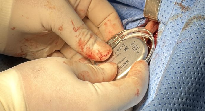 Cardiovascular realiza con éxito tercera jornada de implantes de marcapasos del año