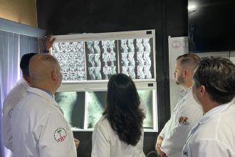 escoliosis
