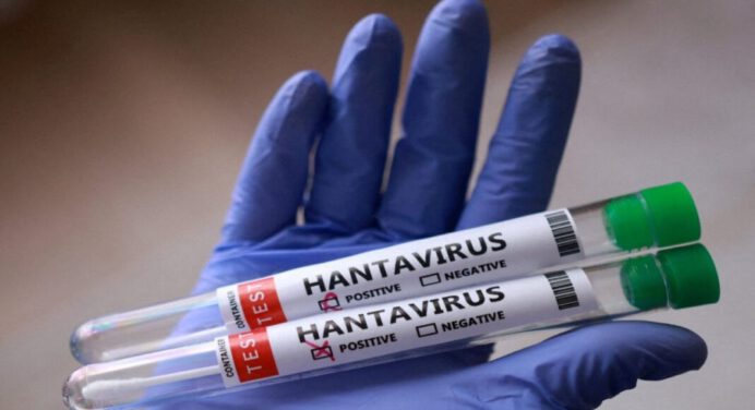 Min-Salud confirmó tres fallecidos por Hantavirus en Anzoátegui
