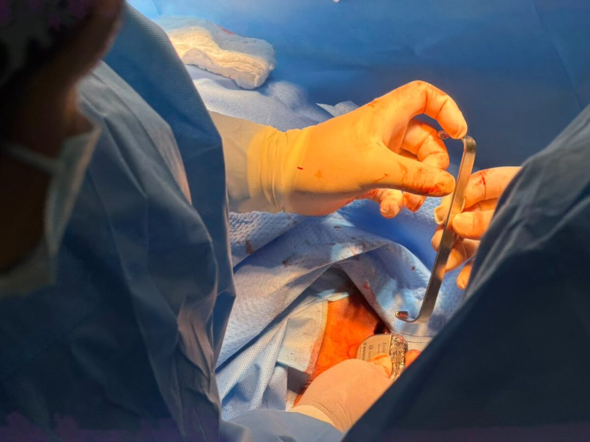 Implantan en Monagas siete nuevos marcapasos totalizando 83 en lo que va de 2026 2 marca2